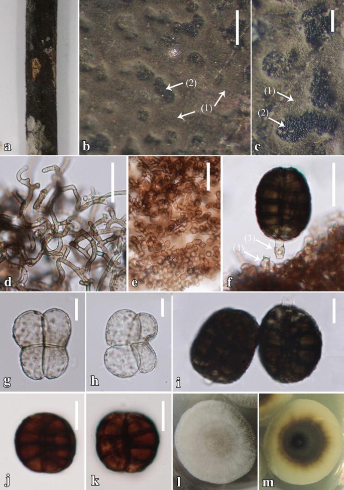 Fungal Diversity Notes 367 490 Taxonomic And Phylogenetic Contributions To Fungal Taxa Springerlink