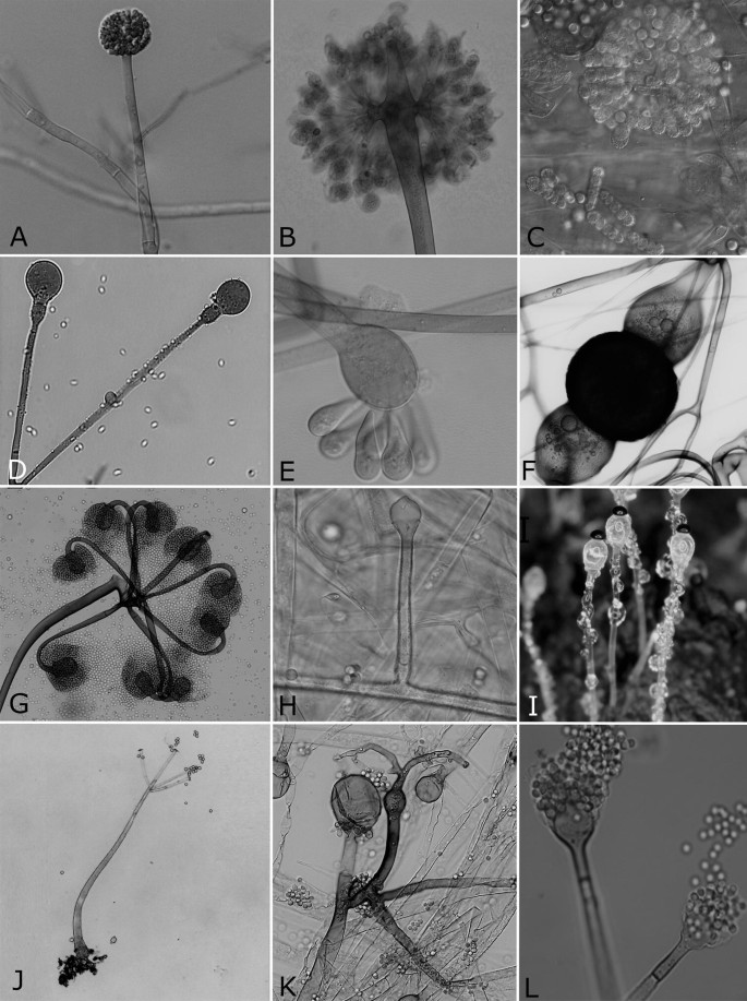 Notes For Genera Basal Clades Of Fungi Including Aphelidiomycota Basidiobolomycota Blastocladiomycota Calcarisporiellomycota Caulochytriomycota Chytridiomycota Entomophthoromycota Glomeromycota Kickxellomycota Monoblepharomycota