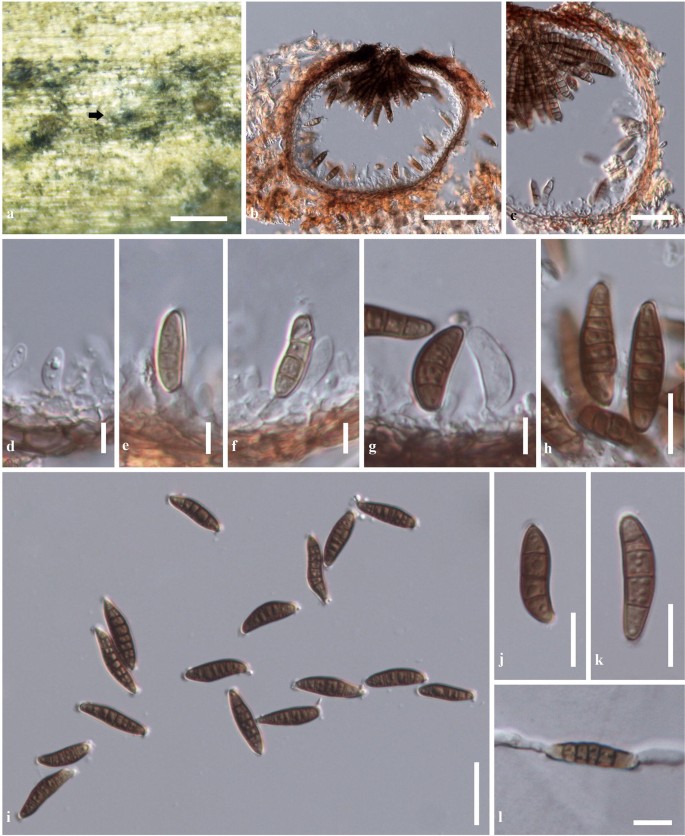 Fungal Diversity Notes 929 1035 Taxonomic And Phylogenetic Contributions On Genera And Species Of Fungi Springerlink