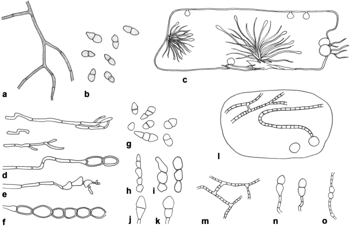 Divergence Time Calibrations For Ancient Lineages Of Ascomycota Classification Based On A Modern Review Of Estimations Springerlink