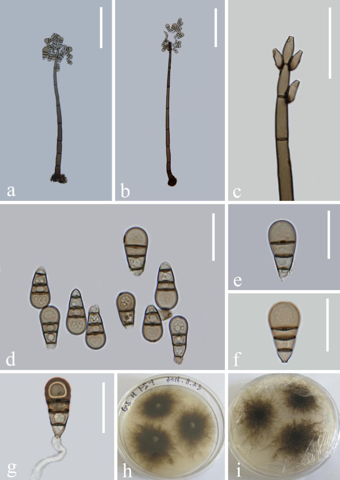 figure 22