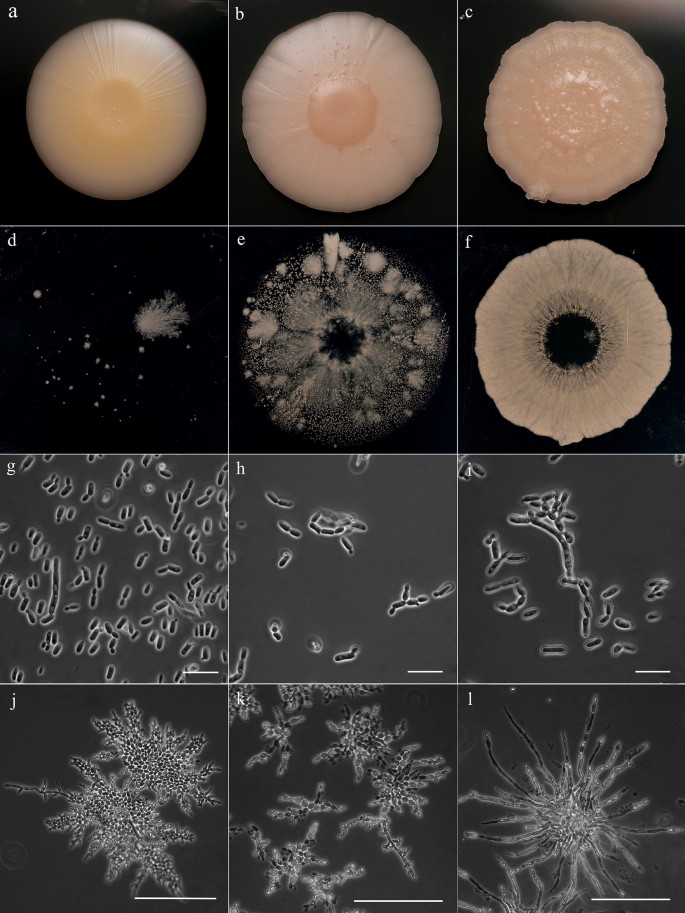 figure 156