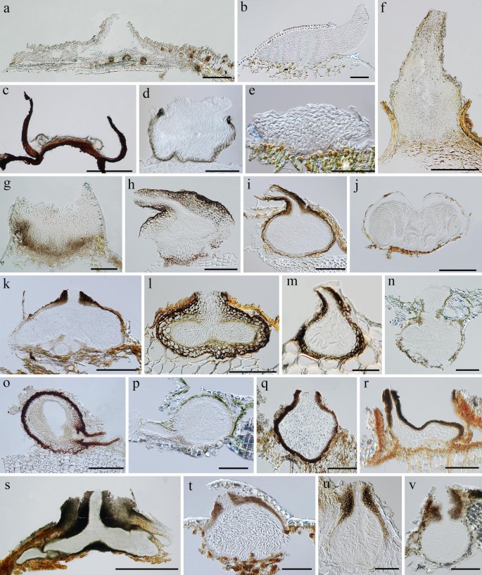 Taxonomy and phylogeny of hyaline-spored coelomycetes | SpringerLink
