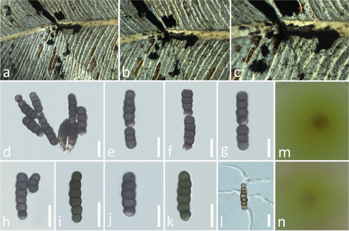 Phylogenetic relationship between strains KKUY-0036, KKUY-0078