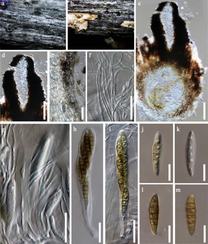 Fungal diversity notes 1387–1511: taxonomic and phylogenetic