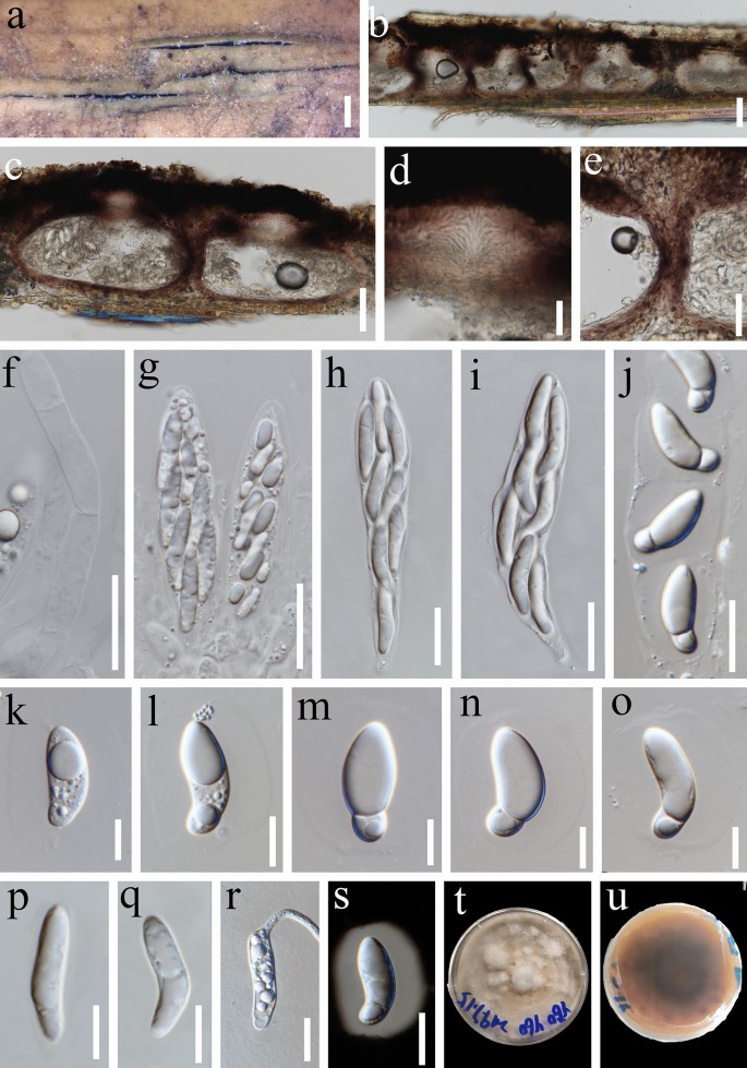 The numbers of fungi: contributions from traditional taxonomic