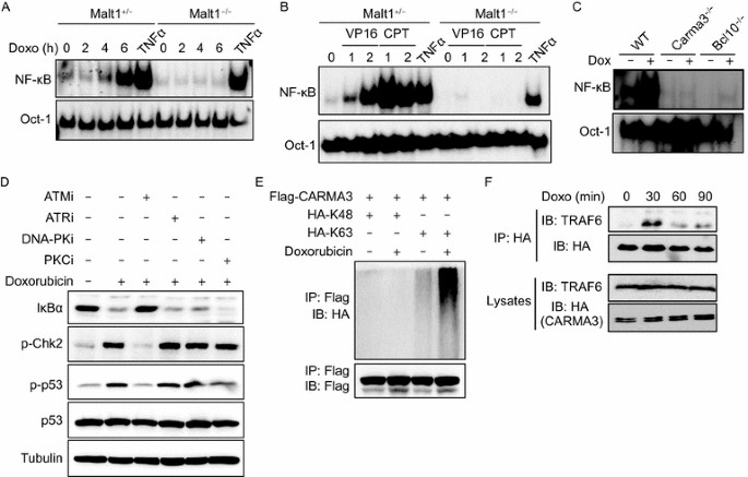 The Carma3 l10 Malt1 Cbm Complex Contributes To Dna Damage Induced Nf Kb Activation And Cell Survival Springerlink The Carma3 l10 Malt1 Cbm Complex Contributes To Dna Damage Induced Nf Kb Activation And Cell Survival Springerlink
