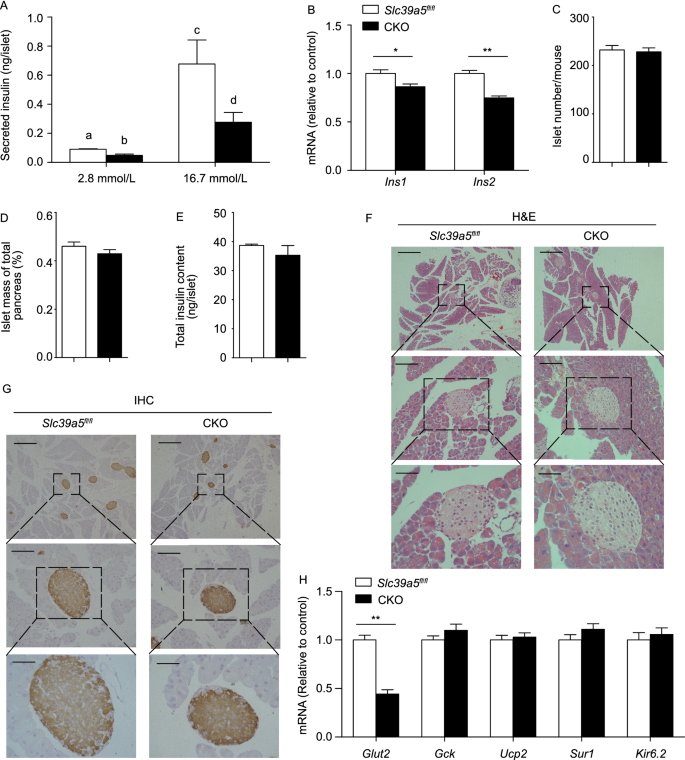 The Zinc Transporter Slc39a5 Controls Glucose Sensing And Insulin Secretion In Pancreatic B Cells Via Sirt1 And Pgc 1a Mediated Regulation Of Glut2 Springerlink