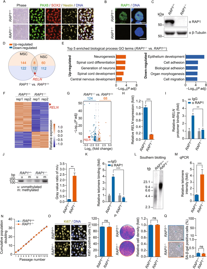 Telomere-dependent and telomere-independent roles of RAP1 in regulating  human stem cell homeostasis | SpringerLink