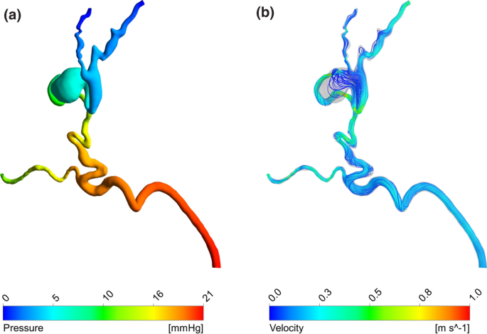 A Computational Framework for Pre-Interventional Planning of 