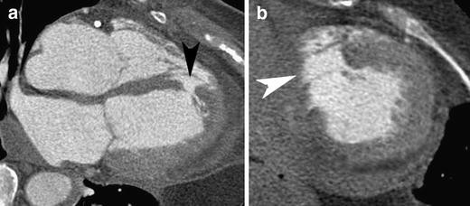 figure 23