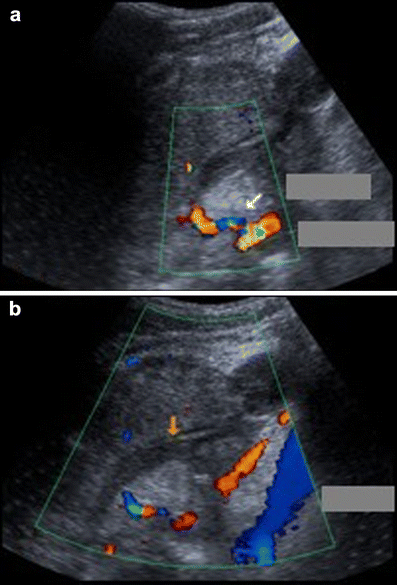 figure 15