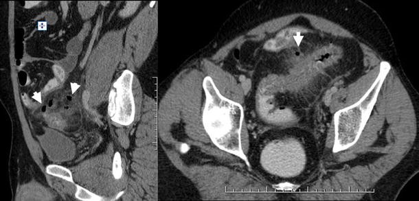 figure 15