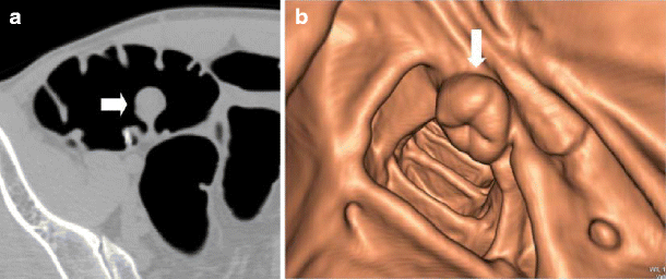 figure 15