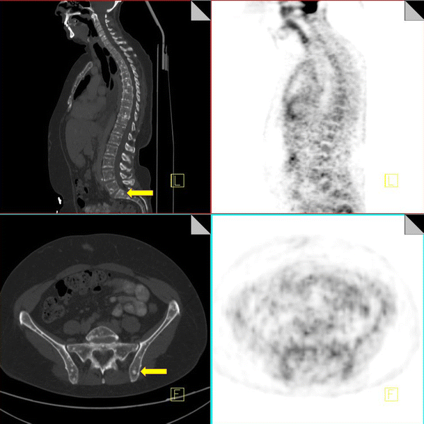 figure 17