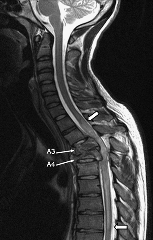 figure 30