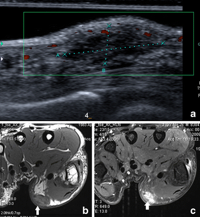 figure 19