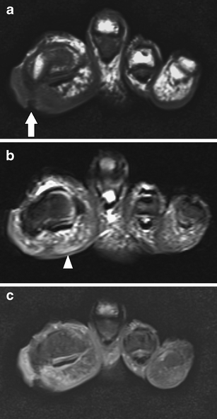 figure 14