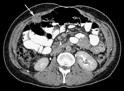 figure 24