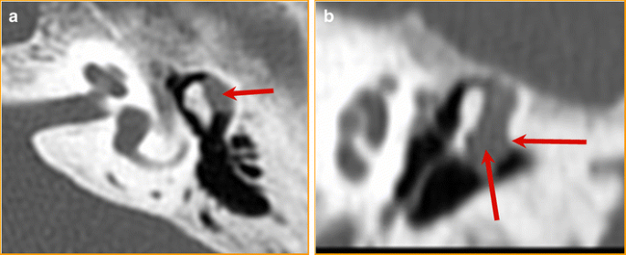 figure 25