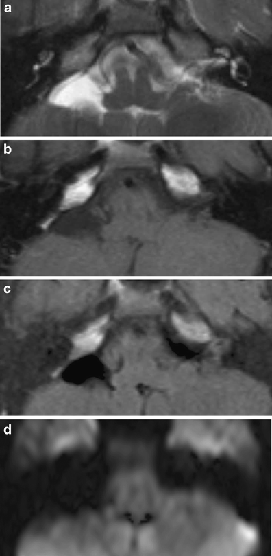 figure 17