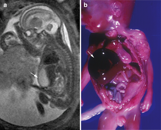 figure 17