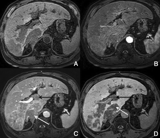 figure 28