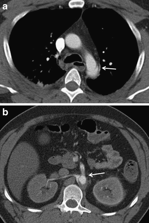 figure 23