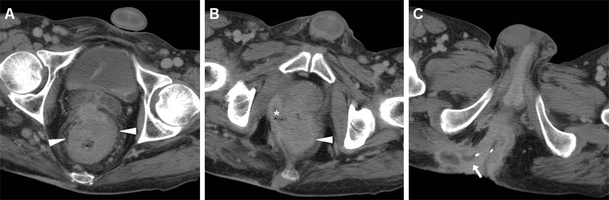 figure 15