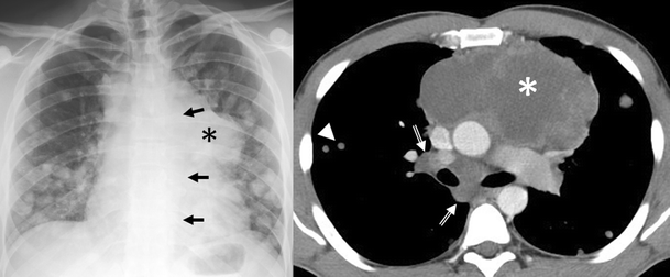 figure 28