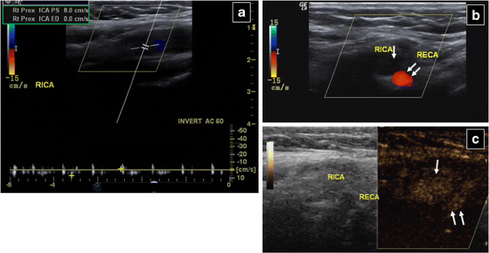 figure 15