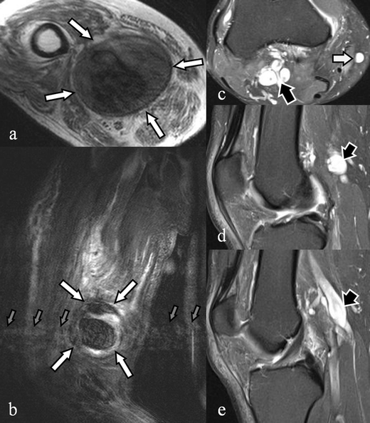 figure 23