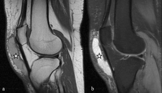 figure 24