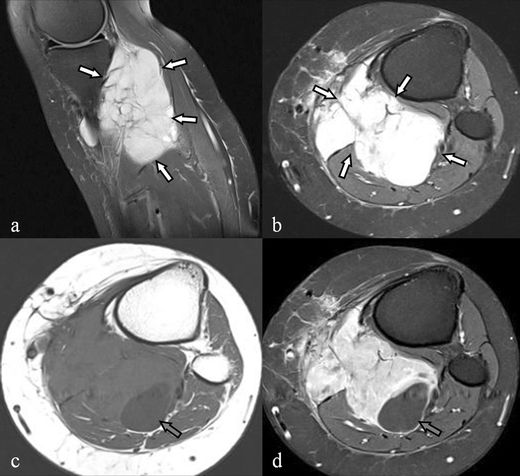 figure 26