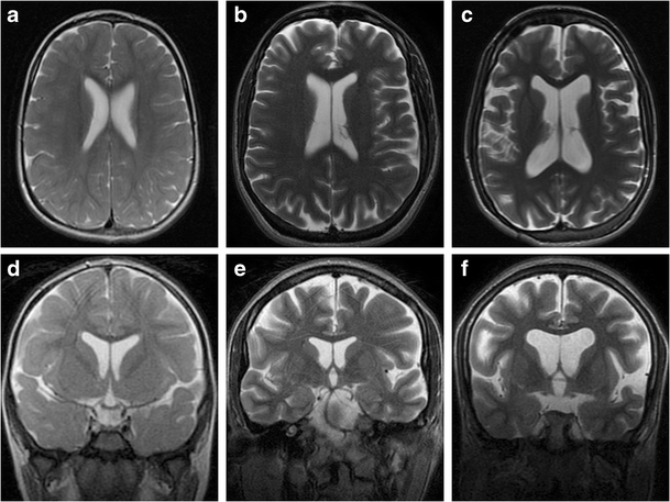 figure 16