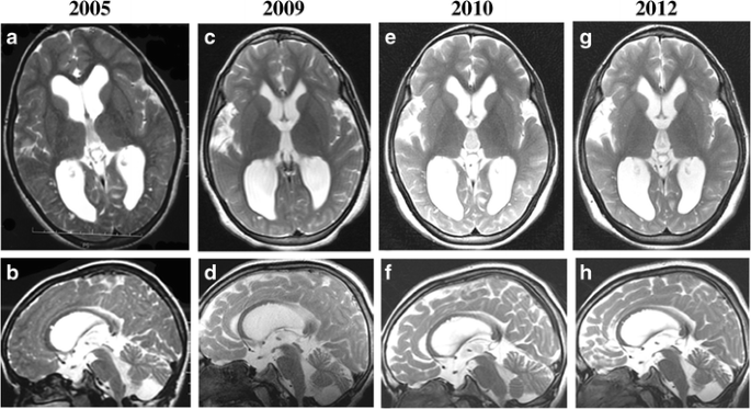 figure 17