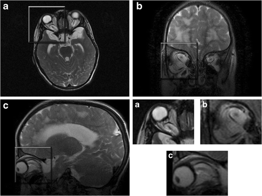 figure 21