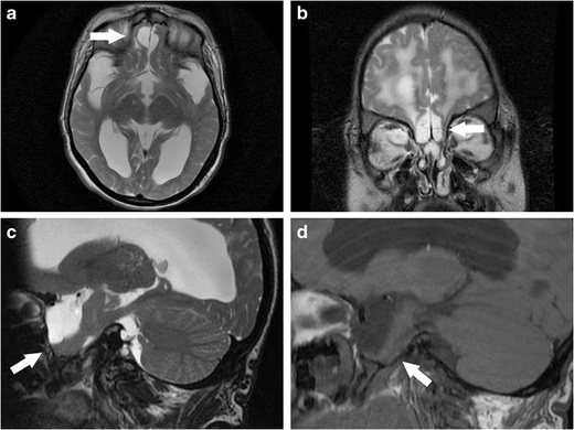 figure 22