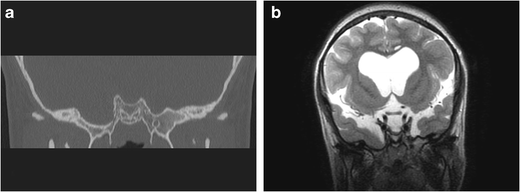 figure 23