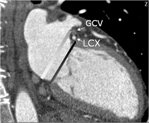 figure 15