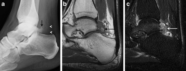 figure 17