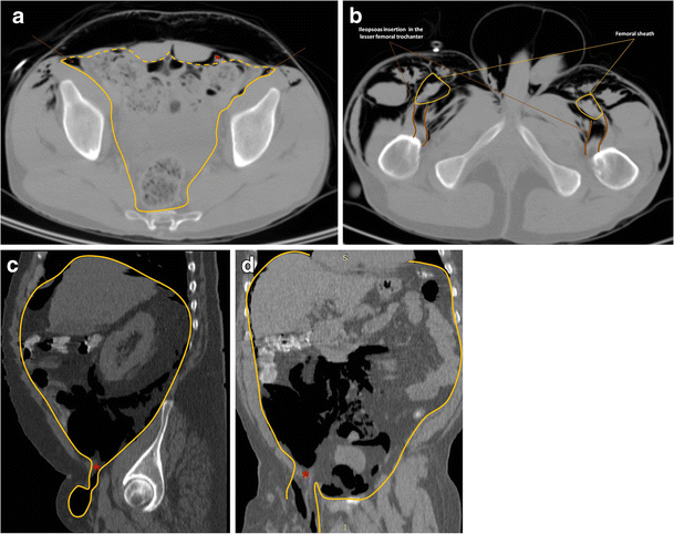 figure 15