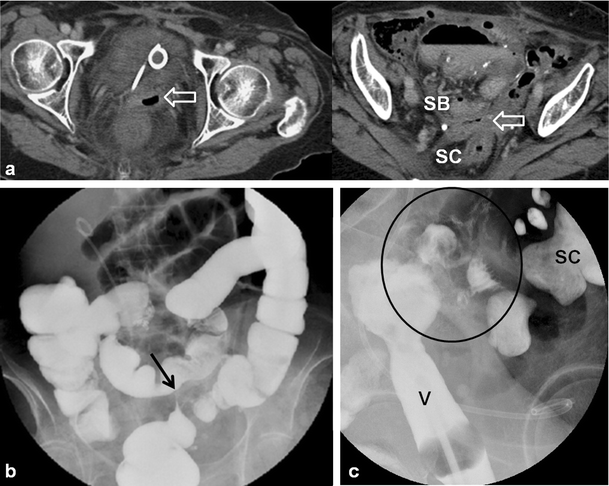 figure 14