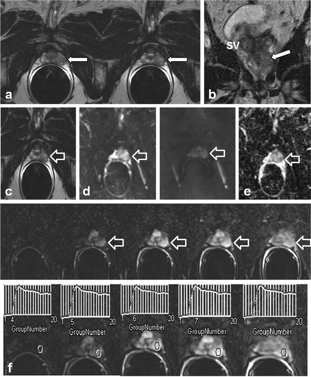 figure 18