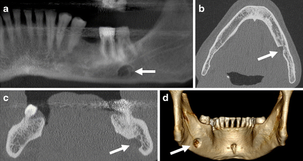 figure 16