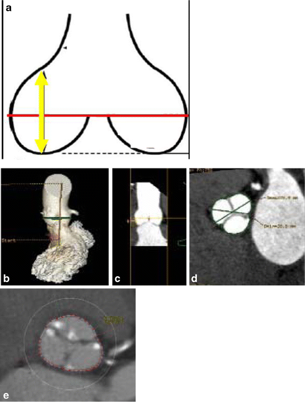 figure 19