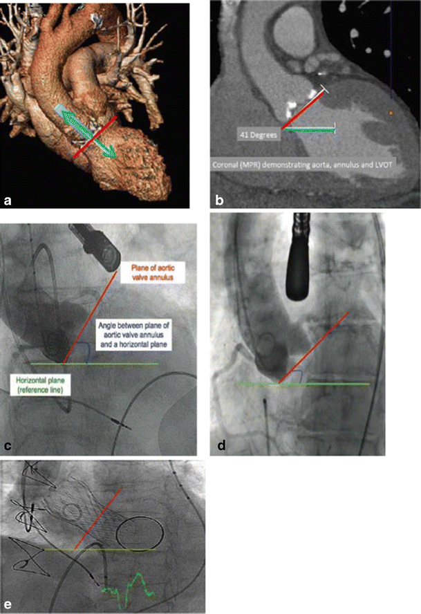 figure 20