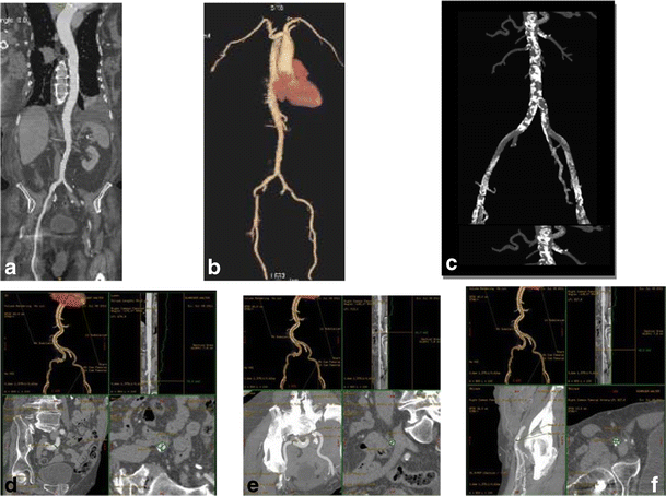 figure 21