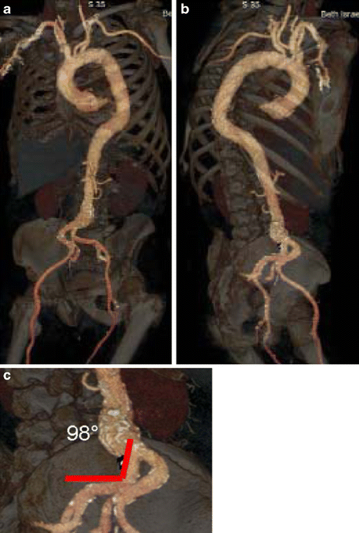 figure 22