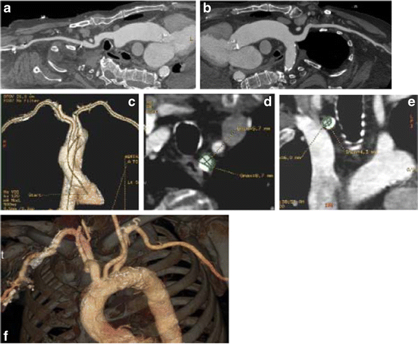 figure 23